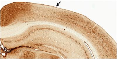 Tau Pathology Profile Across a Parietal-Hippocampal Brain Network Is Associated With Spatial Reorientation Learning and Memory Performance in the 3xTg-AD Mouse